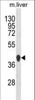 HPD Antibody (aa255-284)