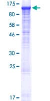 Human PLCL2 Protein (Recombinant GST)
