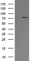 PADI4 / PAD4 Antibody (clone OTI5E7)