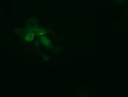 TRMT2A Antibody (clone OTI3B3)