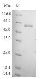 Human TAF5L Protein (Recombinant GST, N-terminus)
