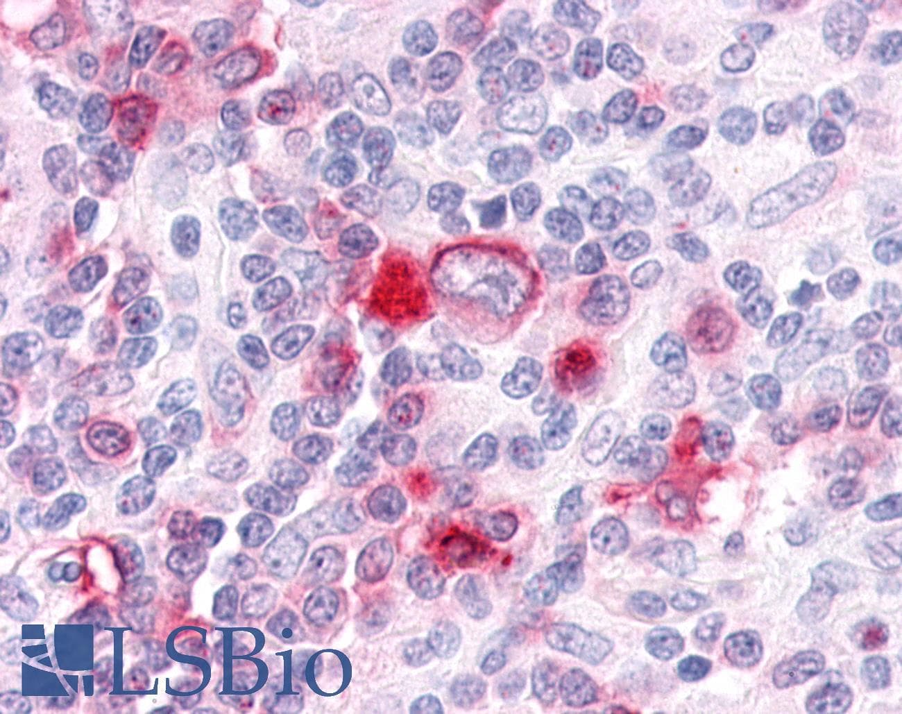 PathPlus™ GPR63 Antibody (C-Terminus)