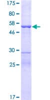 Human MIF4GD Protein (Recombinant GST)