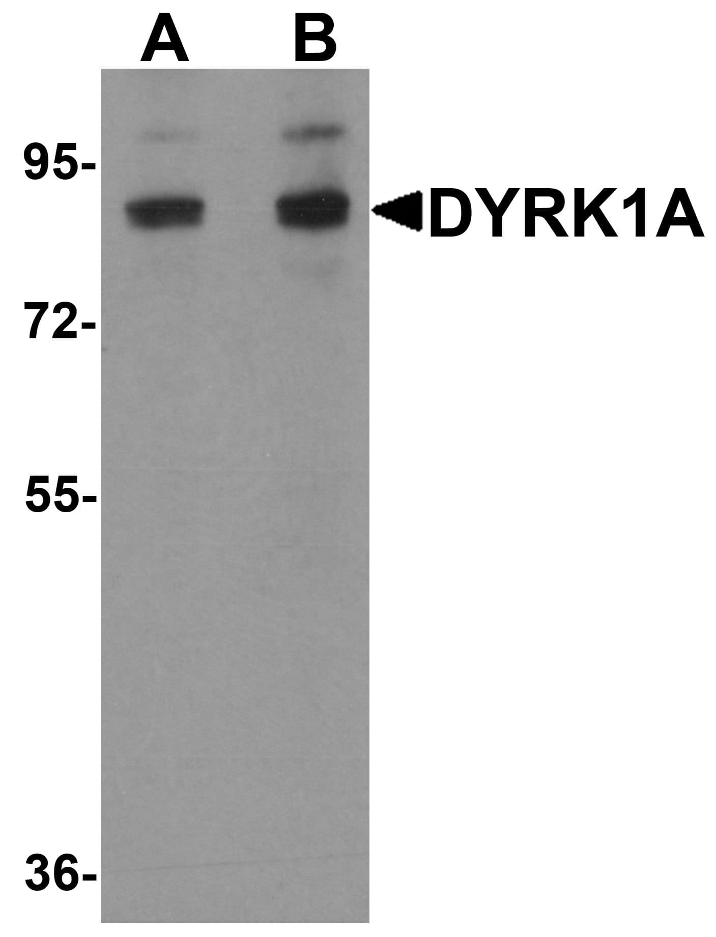 DYRK / DYRK1A Antibody