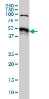 IHC-plus™ Monoclonal Mouse anti-Human STK38 Antibody (clone 6F1, IHC, WB)