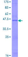 Human RPP21 Protein (Recombinant GST)