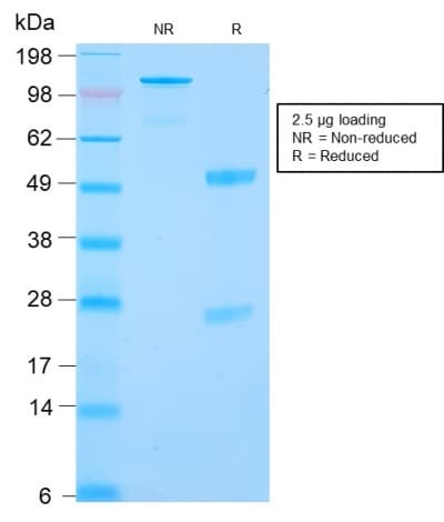 CA9 / Carbonic Anhydrase IX Antibody (clone CA9/2993R)