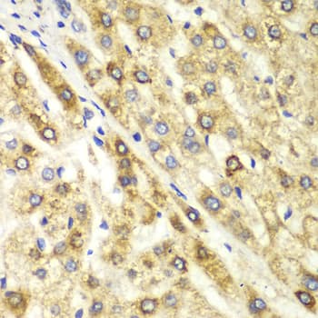 CTBP1 / CTBP Antibody
