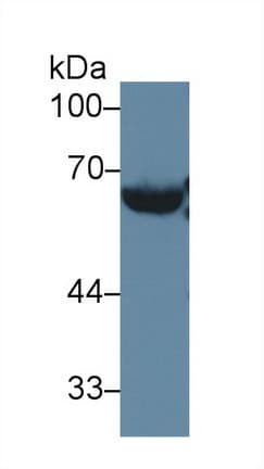 LCAT Antibody (aa290-432)