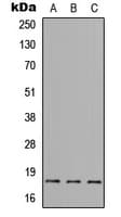 BAX Antibody (N-Terminus)