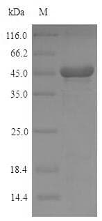 Mouse PDXP / Pyridoxal Phosphatase Protein (Recombinant 6His-SUMO, N-terminus)