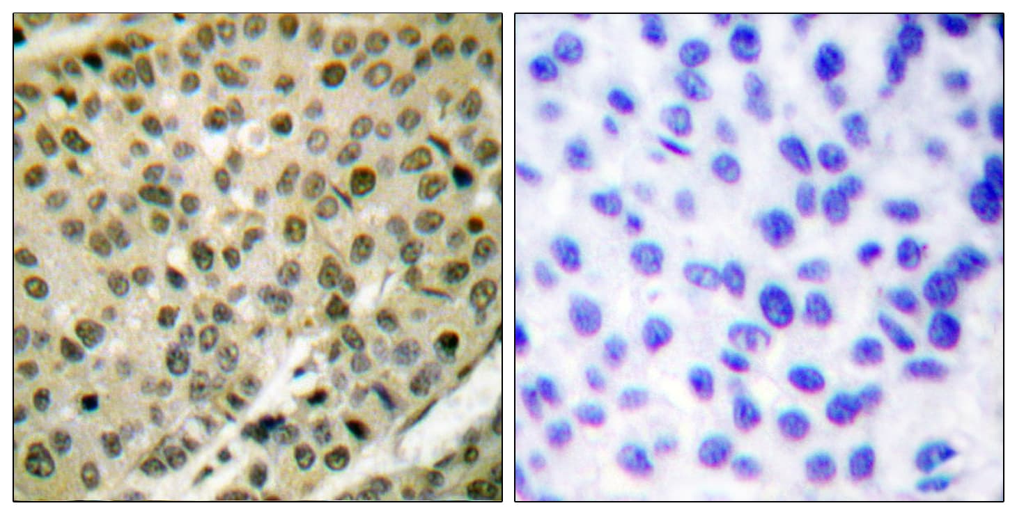 AKT1 Antibody