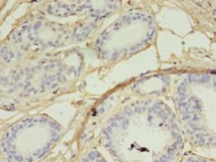 SKP2 Antibody (aa1-424, FITC)