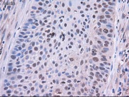 Monoclonal Mouse anti-Human EPCAM Antibody (clone OTI2C8, IHC, WB)
