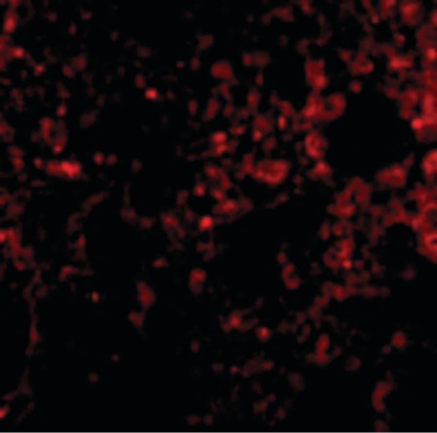 PathPlus™ PSENEN / PEN-2 Antibody