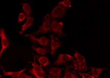 Polyclonal Rabbit anti-Human OR8D1 Antibody (IF, WB)