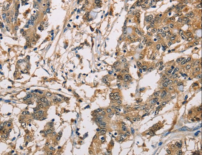 Polyclonal Rabbit anti-Human CBR / CBR1 Antibody (IHC, WB)