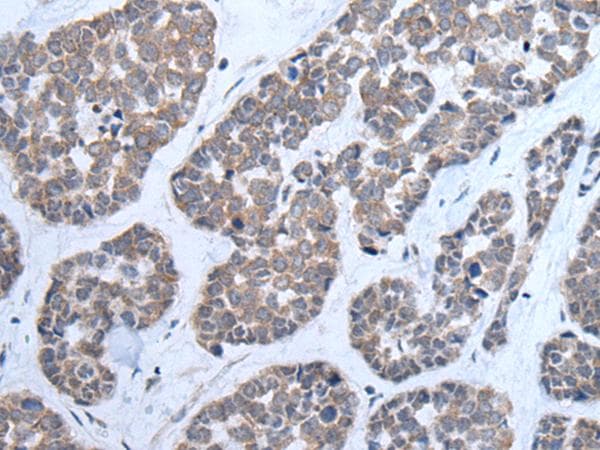 Polyclonal Rabbit anti-Human CNTN1 / gp135 / Contactin 1 Antibody (IHC, WB)