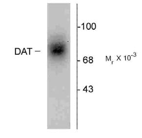 PathPlus™ SLC6A3 / Dopamine Transporter Antibody (EL2 Region)