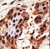 GJB6 / CX30 / Connexin 30 Antibody (aa87-117)
