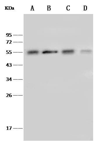 TUBB4 / Tubulin Beta 4 Antibody (Preservative Free)