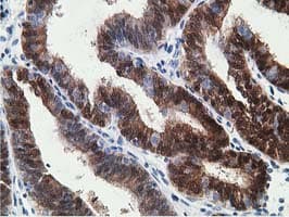 15-PGDH / HPGD Antibody (clone OTI2C10)