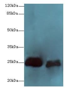 SERTAD1 / TRIP-Br1 / SEI-1 Antibody