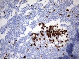 Monoclonal Mouse anti-Human MKI67 / Ki67 Antibody (clone OTI9H1, aa1160-1493, IHC)