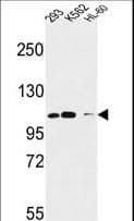 Polyclonal Rabbit anti-Human ROBO4 Antibody (aa236-264, IHC, WB)