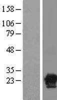 CACYBP Protein (Over-Expression Lysate Myc-DDK (Flag))