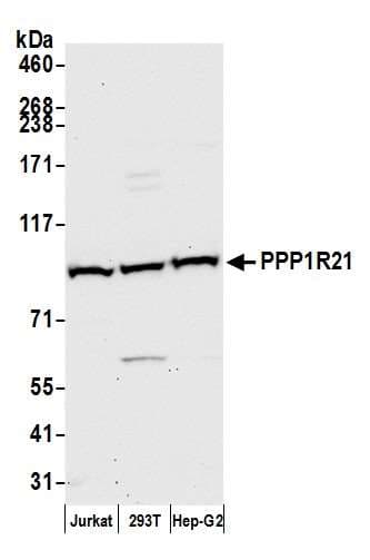 Polyclonal Rabbit anti-Human PPP1R21 / KLRAQ1 Antibody (aa125-175, WB)