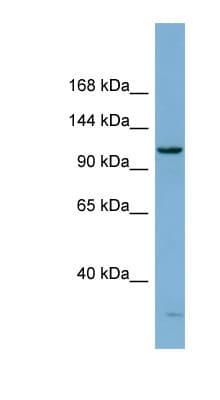 Polyclonal Rabbit anti-Human DHX15 Antibody (aa107-156, WB)