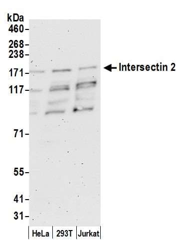 IHC-plus™ Polyclonal Rabbit anti-Human ITSN2 Antibody (aa550-600, IHC, WB)