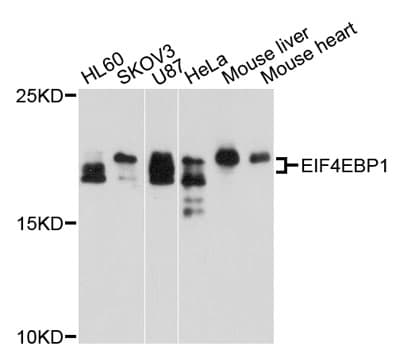 EIF4EBP1 / 4EBP1 Antibody