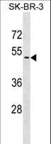 Polyclonal Rabbit anti-Human UGT2B7 Antibody (aa97-126, WB)