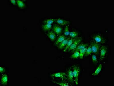 SOCS2 Antibody