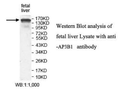 AP3B1 Antibody (aa944-1094)