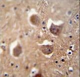 TDRD7 Antibody (aa807-835)