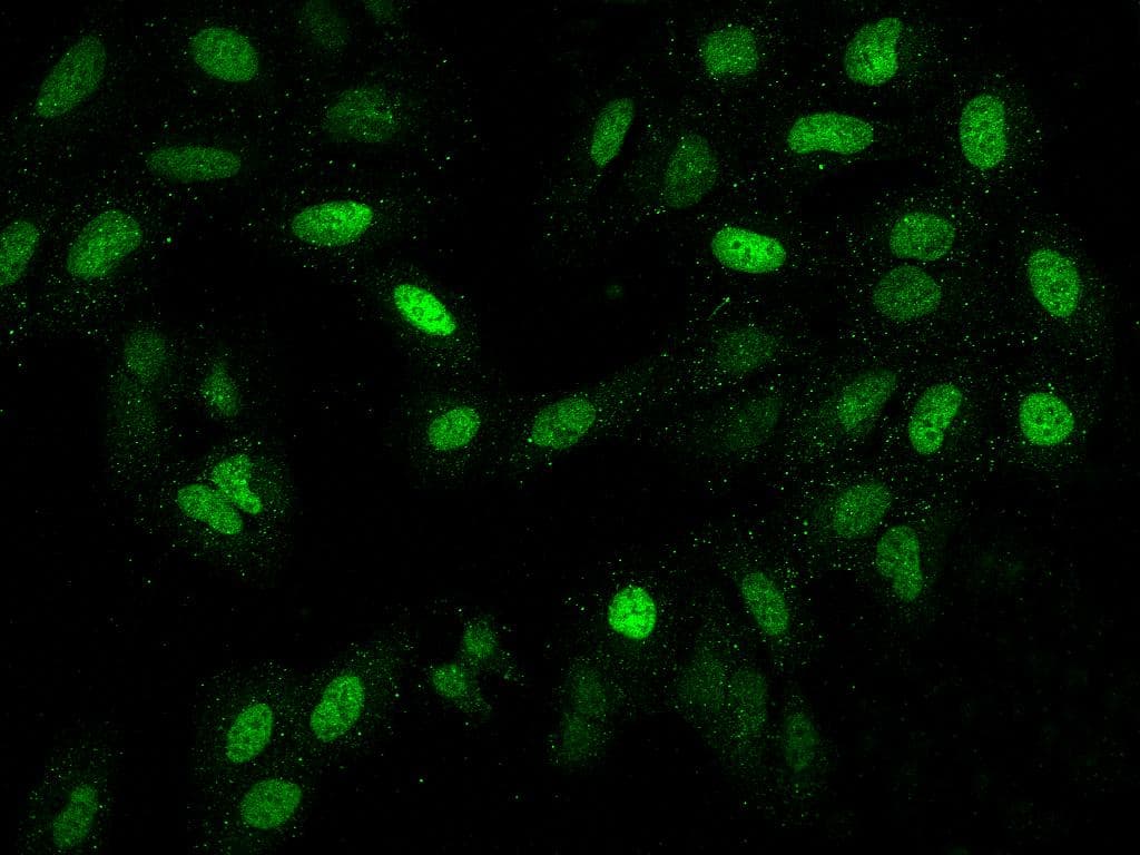 Polyclonal Rabbit anti-Human LAF4 / AFF3 Antibody (IF)