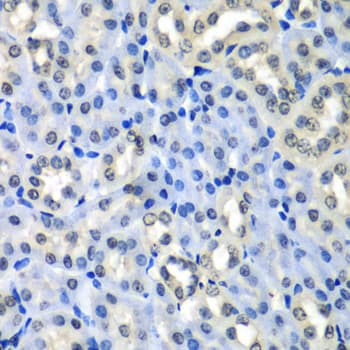Polyclonal Rabbit anti-Human H2AFZ / H2A.z Antibody (IHC, WB)