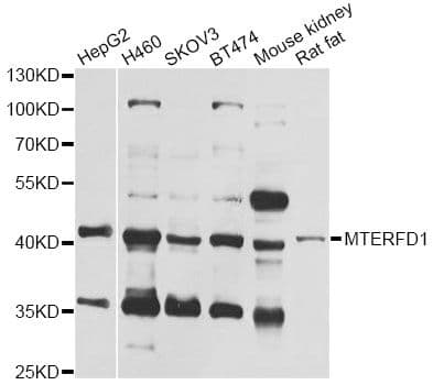 MTERF3 / MTERFD1 Antibody