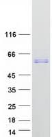 Human AMY1A / Salivary Amylase Protein (Recombinant Myc-DDK (Flag))