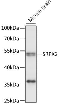 Polyclonal Rabbit anti-Human SRPX2 Antibody (WB)