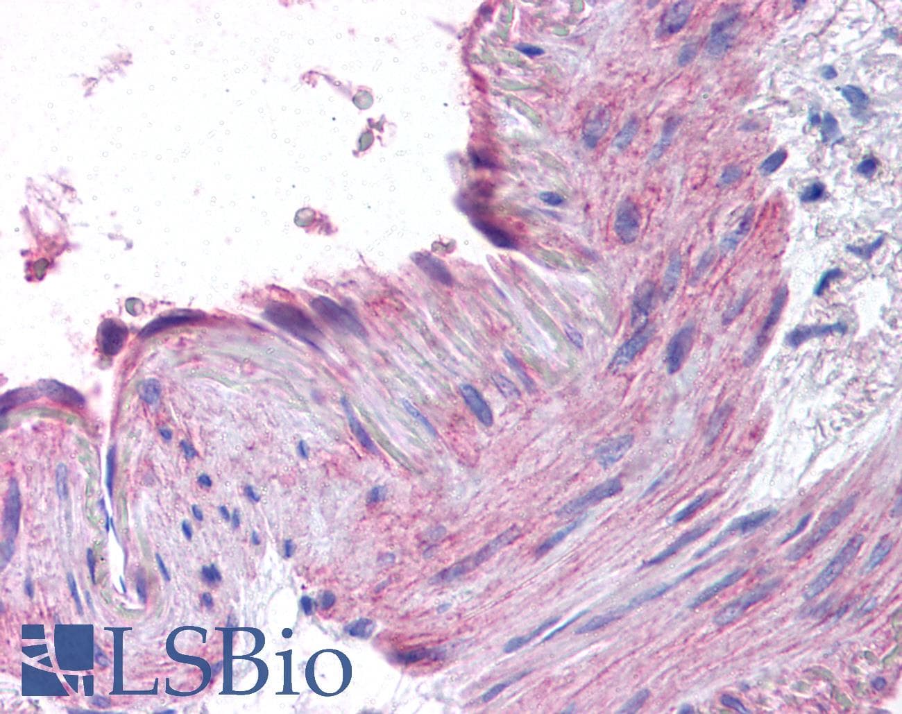 IHC-plus™ CCR1 Antibody (N-Terminus)