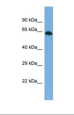 PPP1R18 Antibody (aa405-454)