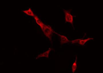 STMN1 / Stathmin / LAG Antibody