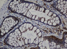CDH1 / E Cadherin Antibody (clone OTI1B11)