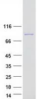 Human WDR48 Protein (Recombinant Myc-DDK (Flag))