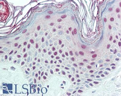 IHC-plus™ Treacle / TCOF1 Antibody (N-Terminus)