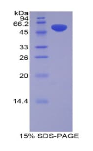 Rat PZP Protein (Recombinant His-GST)